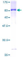 Human IFIT5 Protein (Recombinant GST)