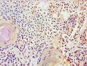 Polyclonal Rabbit anti-Human FUBP3 Antibody (aa65-260, IHC, WB)