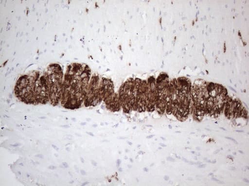 Peripherin Antibody (clone UMAB202, Carrier-free)