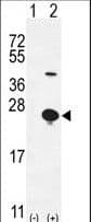 EPGN / Epigen Antibody (aa24-51)