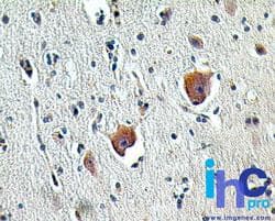 SHARPIN Antibody (aa25-75)