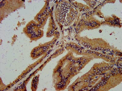 Polyclonal Rabbit anti-Human C5orf13 Antibody (IHC, IF)