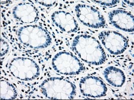 RAD9A / RAD9 Antibody (clone OTI7B11)