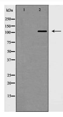 Polyclonal Rabbit anti-Human NEP / DDR1 Antibody (WB)