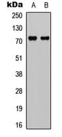 DDX3 / DDX3X Antibody (Internal)