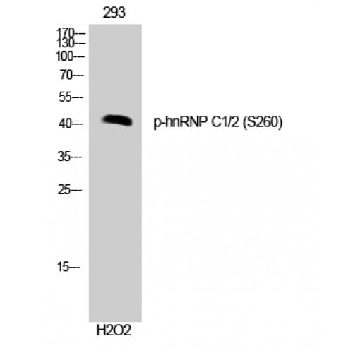 Polyclonal Rabbit anti-Human HNRNPC / HNRNP C Antibody (200-280 aa, IHC, WB)
