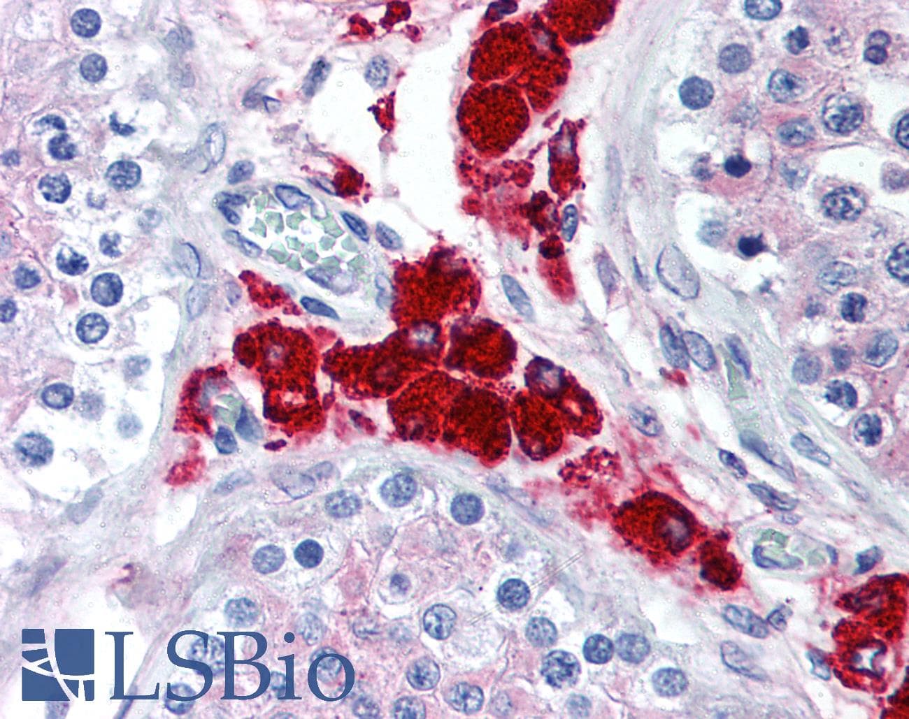IHC-plus™ Polyclonal Rabbit anti-Human DUSP16 / MKP7 Antibody (aa600-650, IHC, WB)