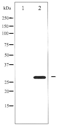 BCL2 / Bcl-2 Antibody (phospho-Ser87)