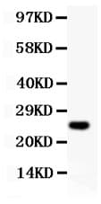 Polyclonal Rabbit anti-Human CCND3 / Cyclin D3 Antibody (aa136-292, WB)