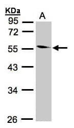 Polyclonal Rabbit anti-Human CORO1B Antibody (aa1-213, IHC, WB)
