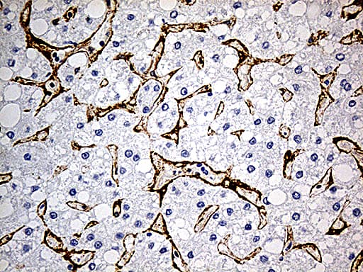 Monoclonal Mouse anti-Human CAV1 / Caveolin 1 Antibody (clone OTI2C4, aa2-104, IHC, WB)
