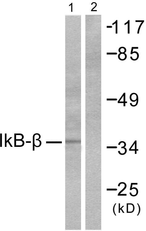 Polyclonal Rabbit anti-Human NFKBIB / IKB Beta / IKBB Antibody (p19, WB)