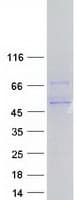 Human PPP2R5C Protein (Recombinant Myc-DDK (Flag))