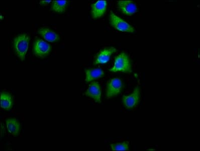 SLC27A1 / FATP Antibody