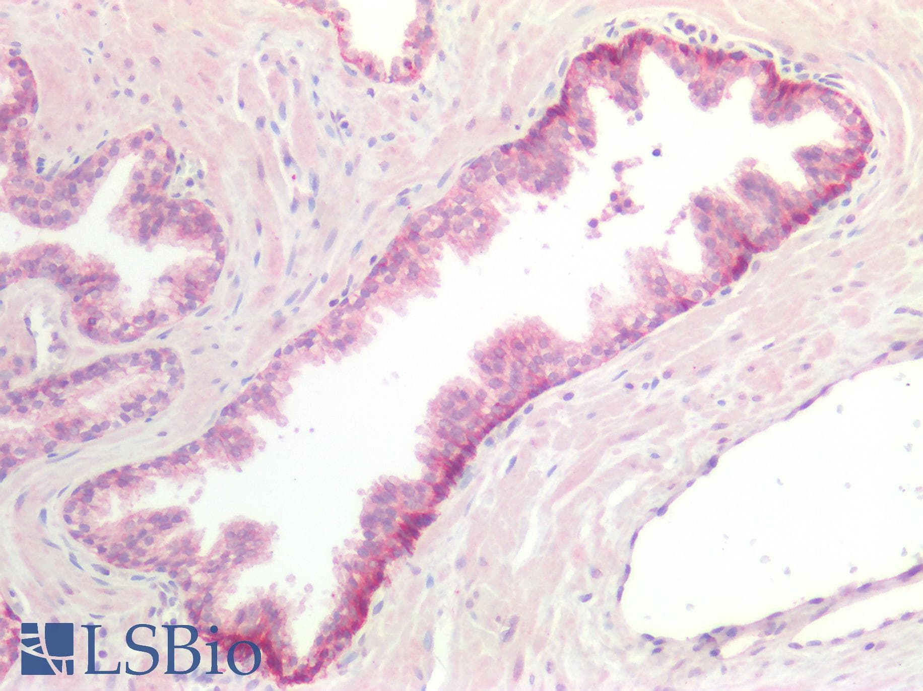 PathPlus™ CDH3 / P-Cadherin Antibody