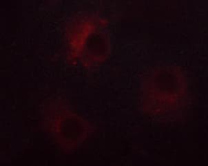 NCF1 / p47phox / p47 phox Antibody (phospho-Ser359)