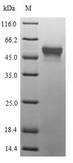 Mycoplasma pneumoniae pepP Protein (Recombinant 6His-SUMO, N-terminus)