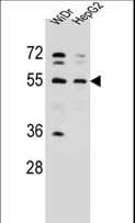 Polyclonal Rabbit anti-Human NARS Antibody (aa24-53, IHC, WB)