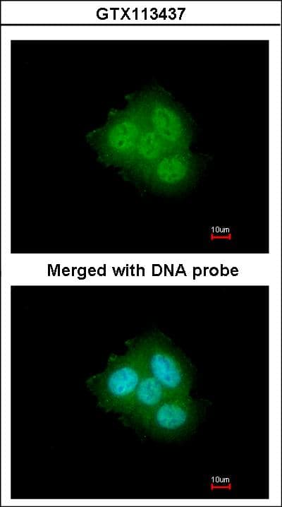 FKBP4 / FKBP52 Antibody (aa1-207)