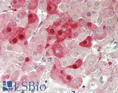 IHC-plus™ FSHB / FSH Beta Antibody (Internal)