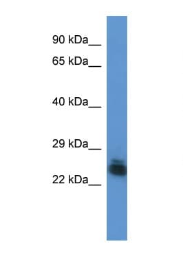 Polyclonal Rabbit anti-Human FYTTD1 Antibody (aa134-183, WB)