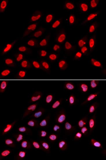 Polyclonal Rabbit anti-Human NONO / P54NRB Antibody (IHC, IF, WB)