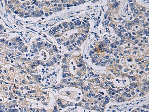 CHST3 Antibody