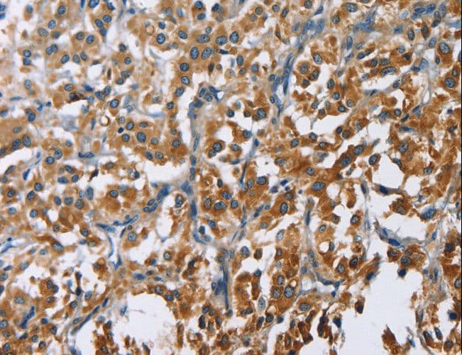 Polyclonal Rabbit anti-Human CARD9 Antibody (IHC)