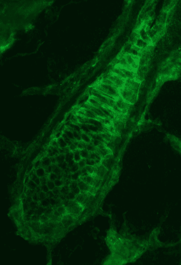 IHC-plus™ PKP3 / Plakophilin 3 Antibody (clone 23E3/4)