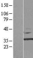 CAB39L Protein (Over-Expression Lysate Myc-DDK (Flag))