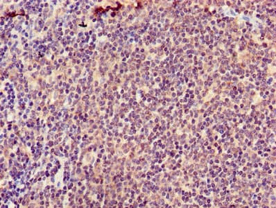 AICAR / ATIC Antibody