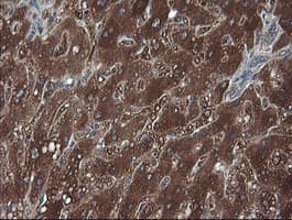 TCL / RHOJ Antibody (clone OTI1C8)