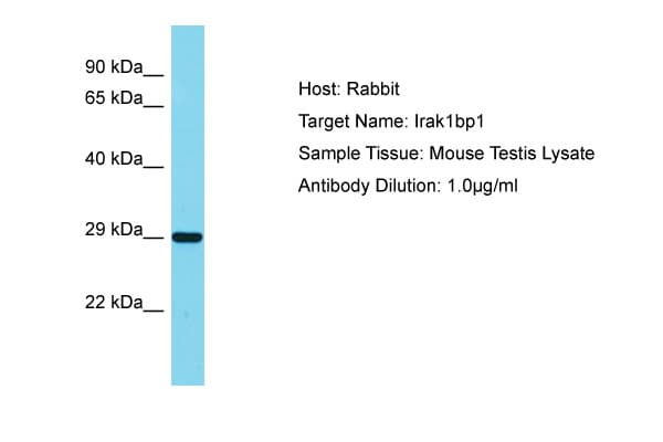 SIMPL / IRAK1BP1 Antibody (C-Terminus)