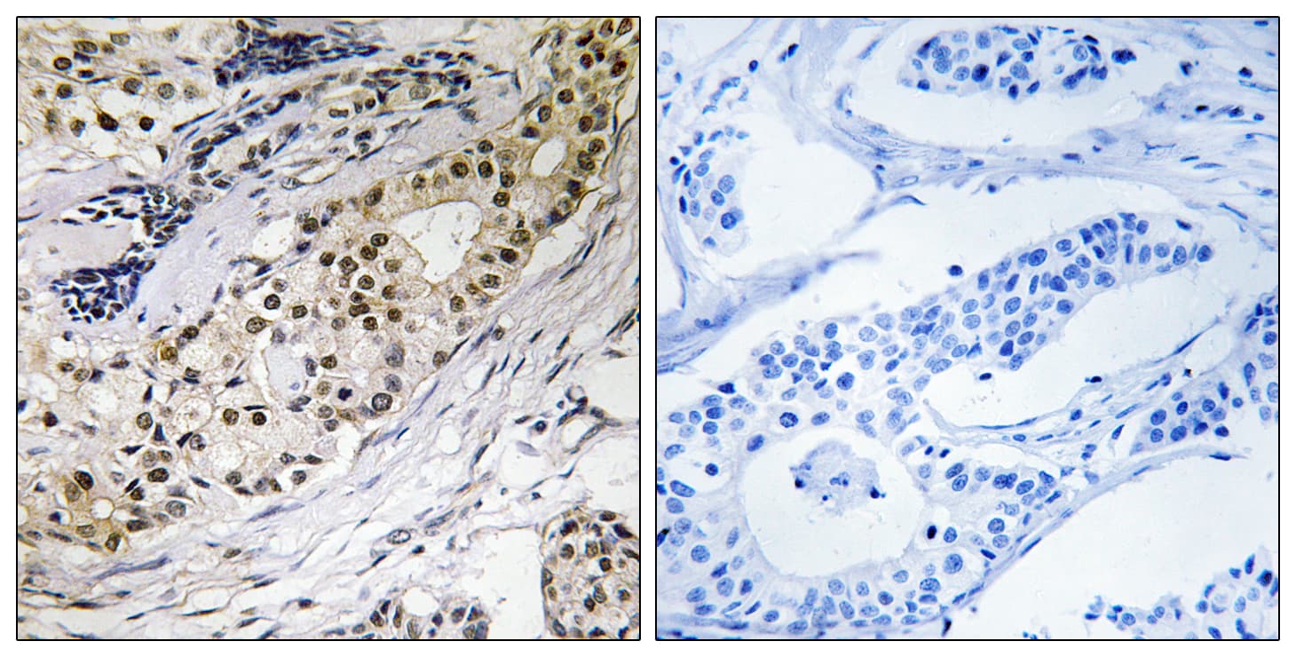 LAMA3 / Laminin Alpha 3 Antibody (aa2571-2620)