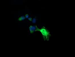 UBE2G2 Antibody (clone OTI1D7)