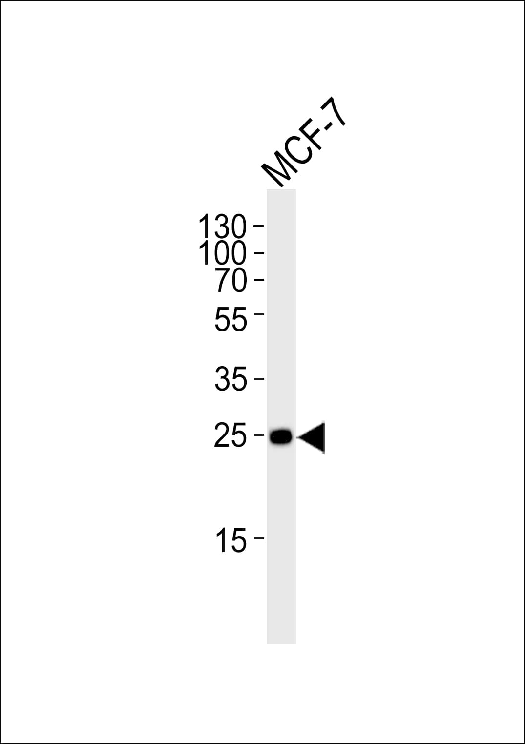 CDKN1B / p27 Kip1 Antibody (aa81-113)