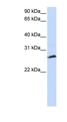SYCP3 / SCP3 Antibody (N-Terminus)