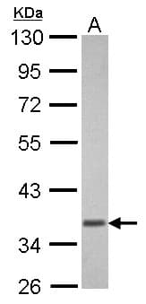 Polyclonal Rabbit anti-Human GNAT1 Antibody (WB)