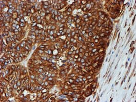 TUBB4 / Tubulin Beta 4 Antibody (clone OTI3F1, Carrier-free)
