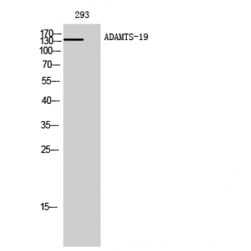 ADAMTS19 Antibody (220-300 aa, Internal)