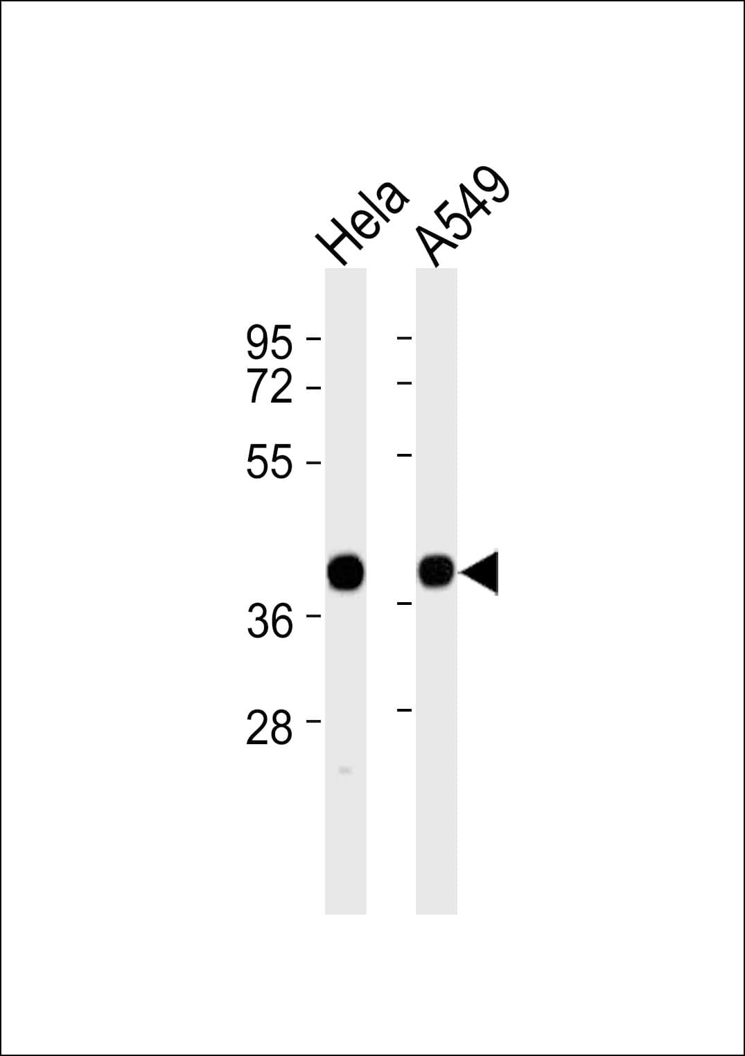 ALDOA / Aldolase A Antibody