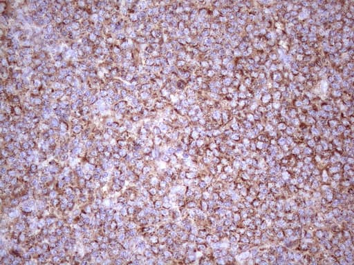 p16INK4a / CDKN2A Antibody (clone OTI2G1)