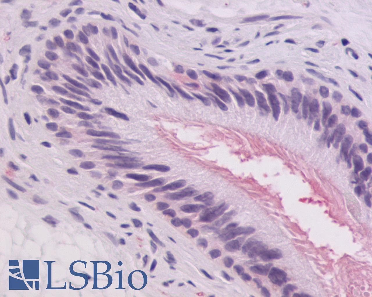 IHC-plus™ Polyclonal Rabbit anti-Human ADGRG2 / GPR64 Antibody (C-Terminus, IHC)