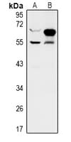 Polyclonal Rabbit anti-Human ZNF446 Antibody (WB)