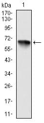 IHC-plus™ RPS6KA3 / RSK2 Antibody (clone 4E10)