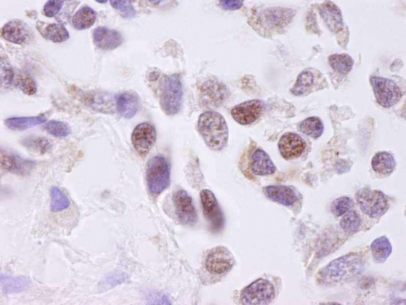 CSNK2A1 Antibody (aa300-350)
