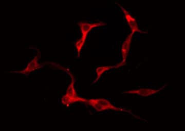 ADGRE2 / EMR2 Antibody
