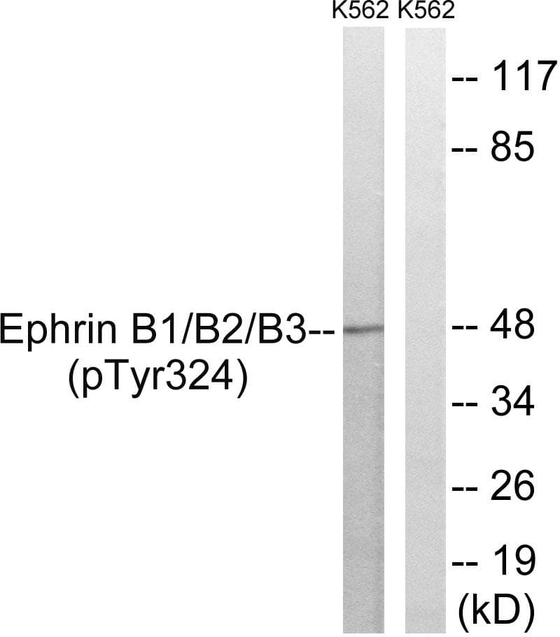 EPH Receptor B1+B2+B3 Antibody (phospho-Tyr324)