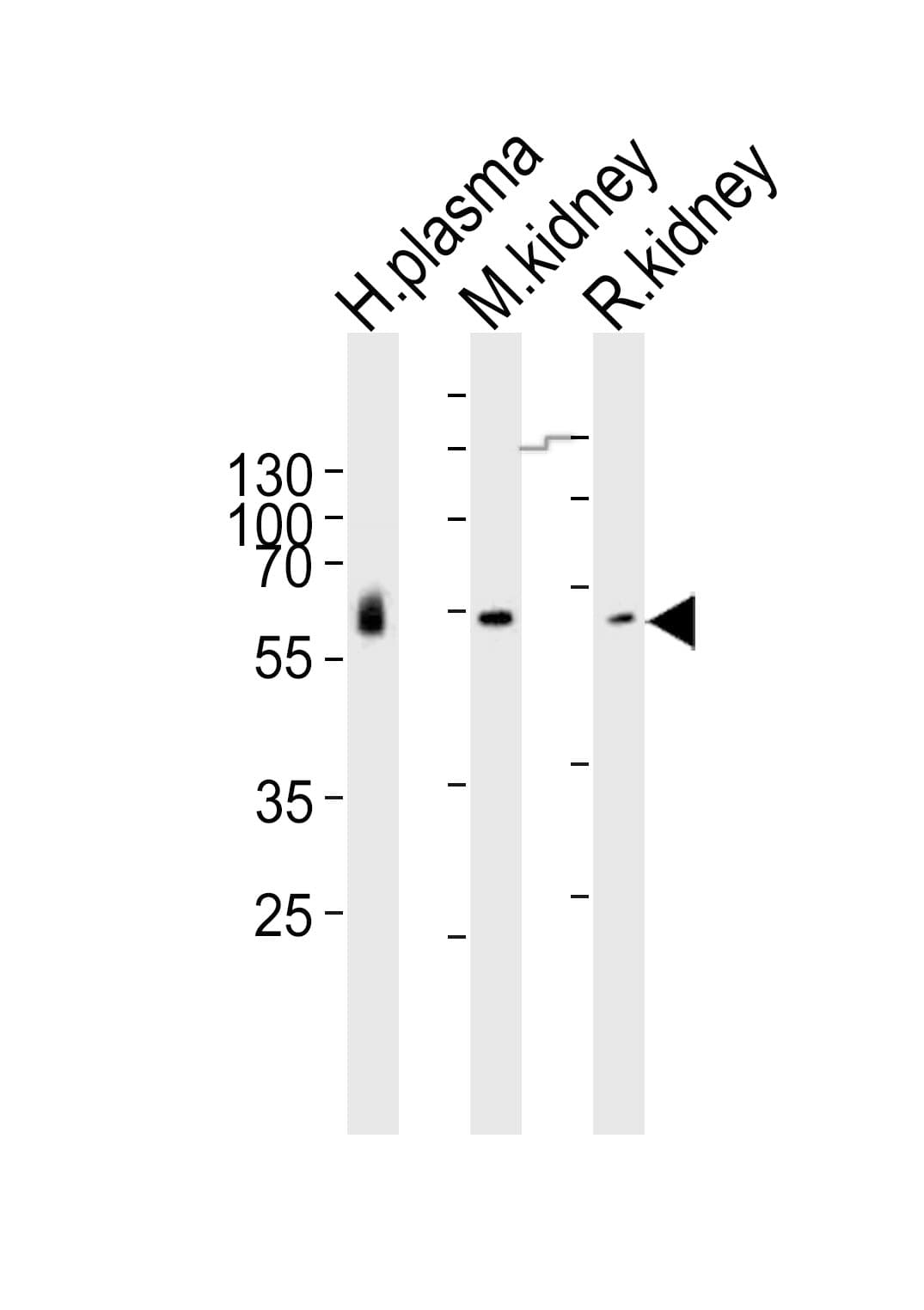 Polyclonal Rabbit anti-Human CNDP1 Antibody (aa128-142, WB)