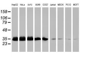 EXOSC7 Antibody (clone OTI1G8)